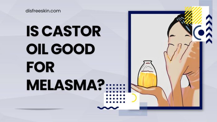 Is Castor Oil Good For Melasma
