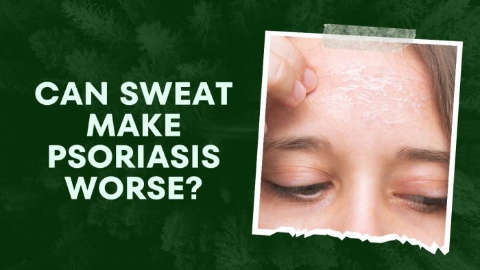Can sweat make psoriasis worse