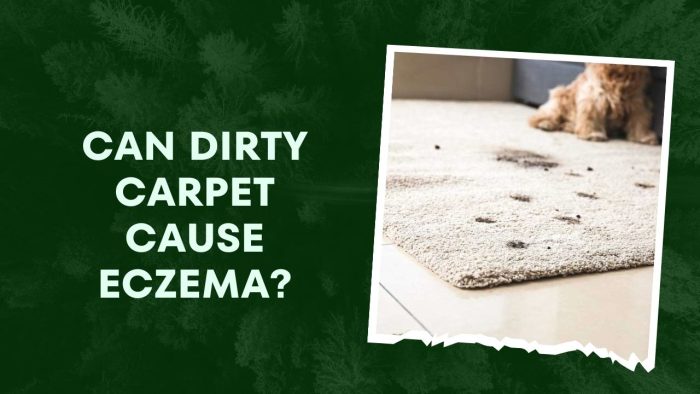 Can Dirty Carpet Cause Eczema