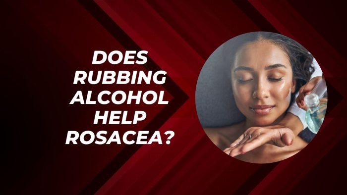 Does Rubbing Alcohol Help Rosacea