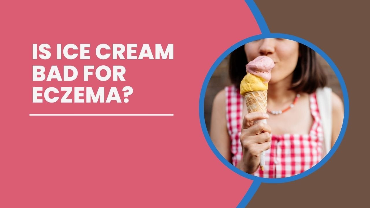 Is Ice Cream Bad For Eczema