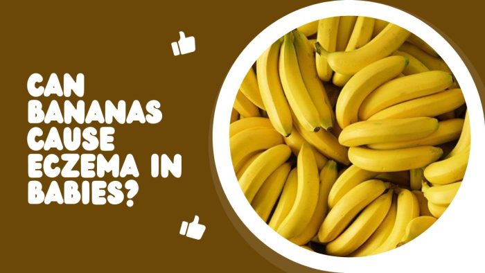 Can Bananas Cause Eczema In Babies