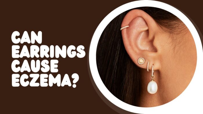 Can Earrings Cause Eczema