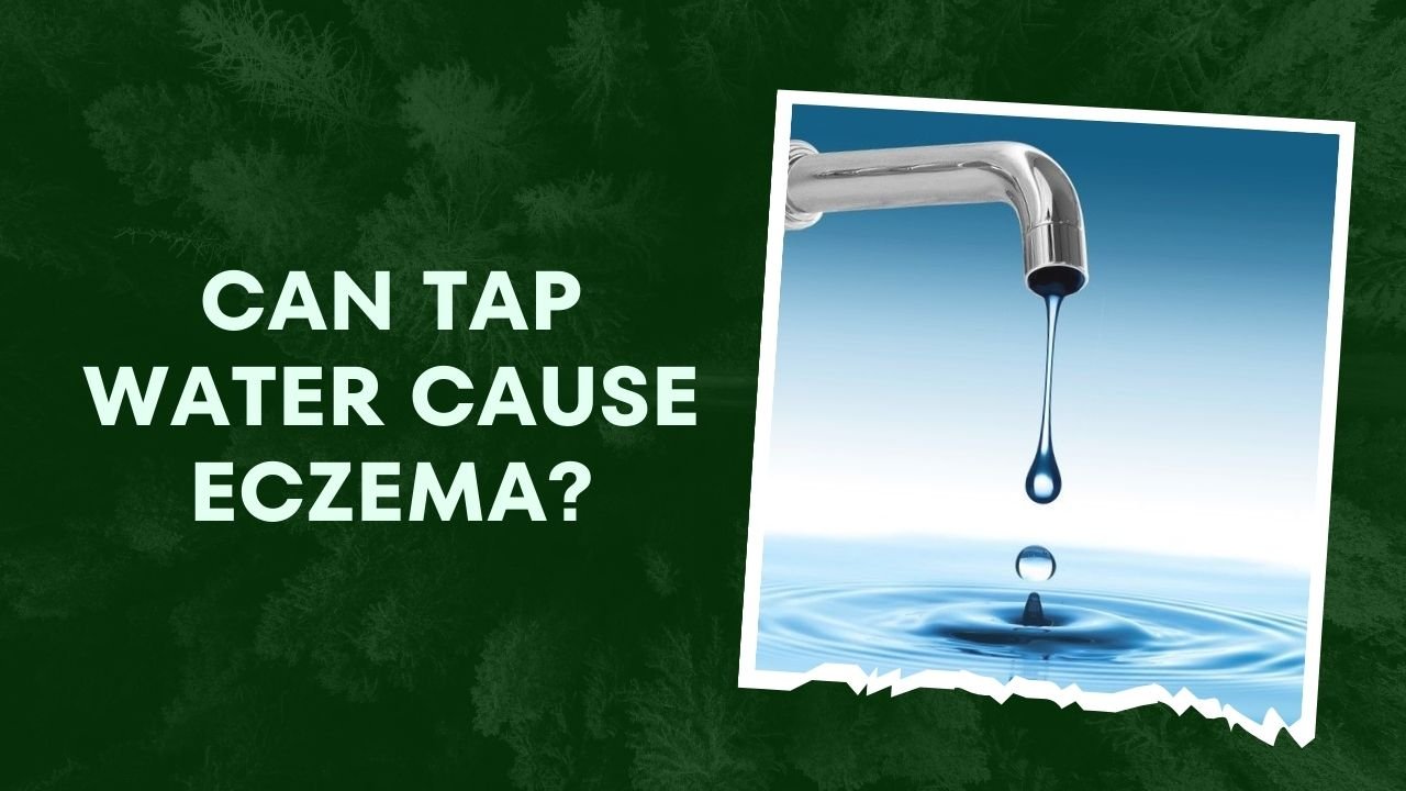 Can Tap Water Cause Eczema