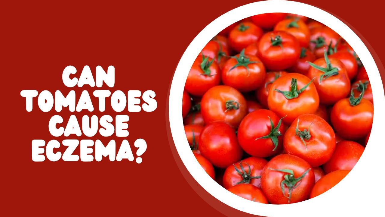 Can Tomatoes Cause Eczema