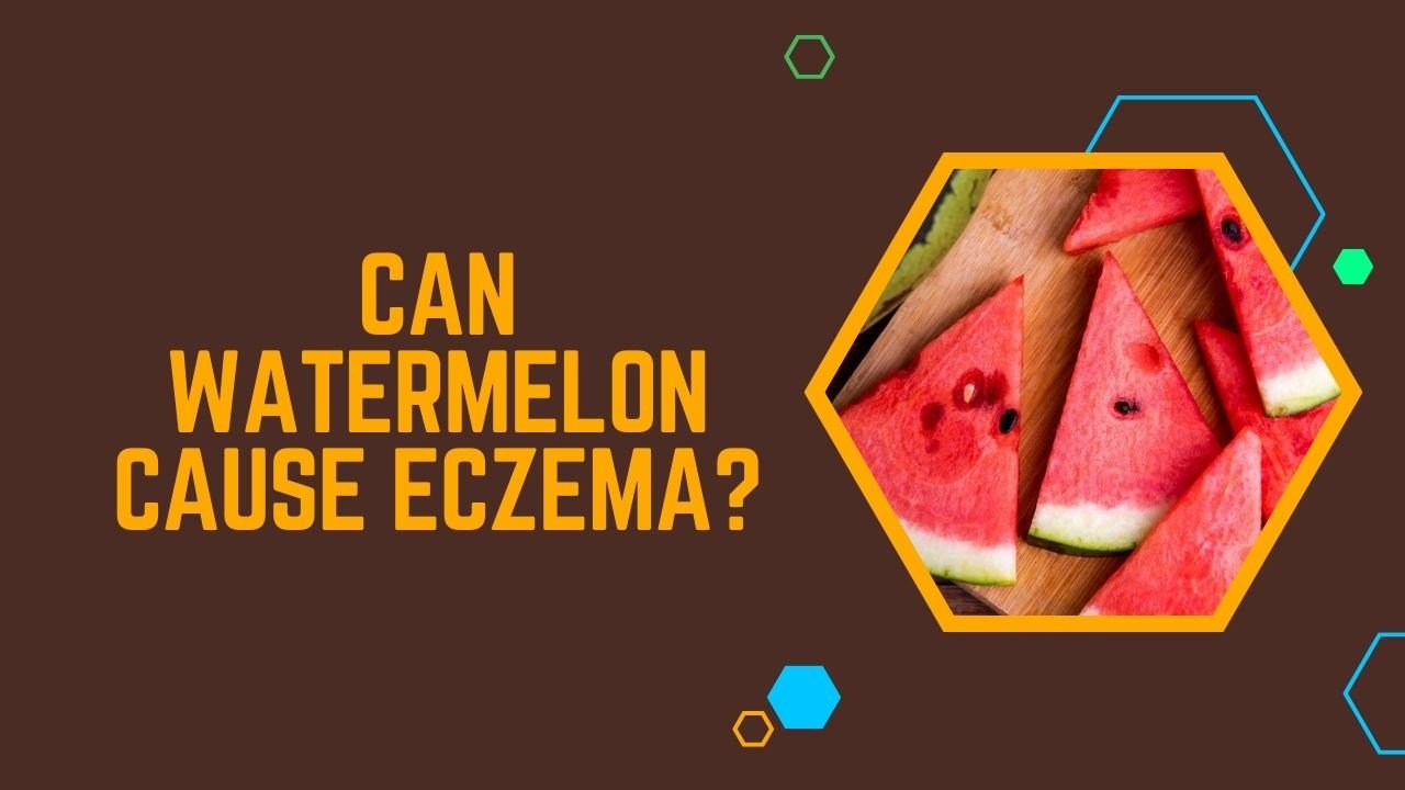 Can Watermelon Cause Eczema