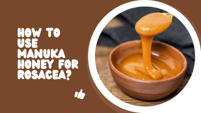 How To Use Manuka Honey For Rosacea