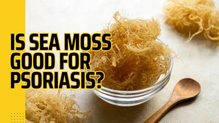 Is Sea Moss Good For Psoriasis