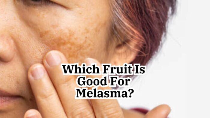 Which Fruit Is Good For Melasma