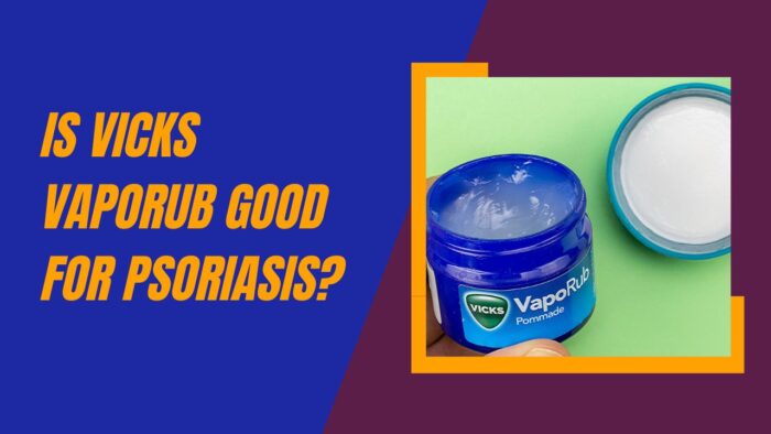Is Vicks Vaporub Good For Psoriasis