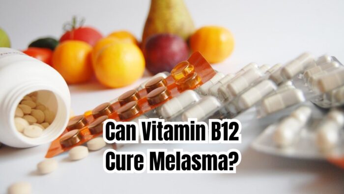 Can Vitamin B12 Cure Melasma?