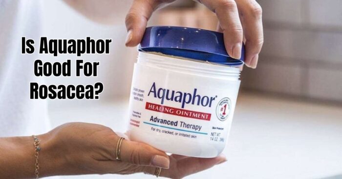 Is Aquaphor Good For Rosacea